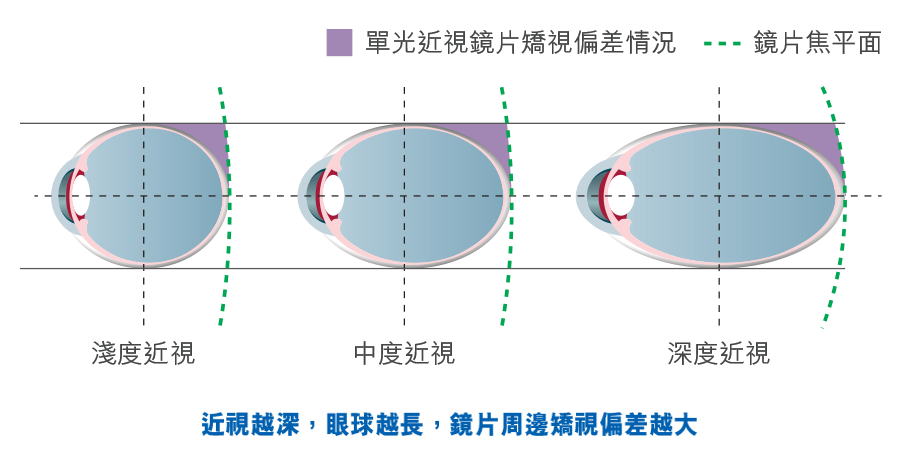 MYO ProTECH 1b_tchi