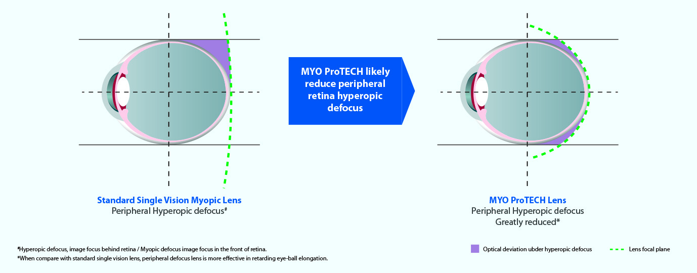 MyopiaMonitring_Image16