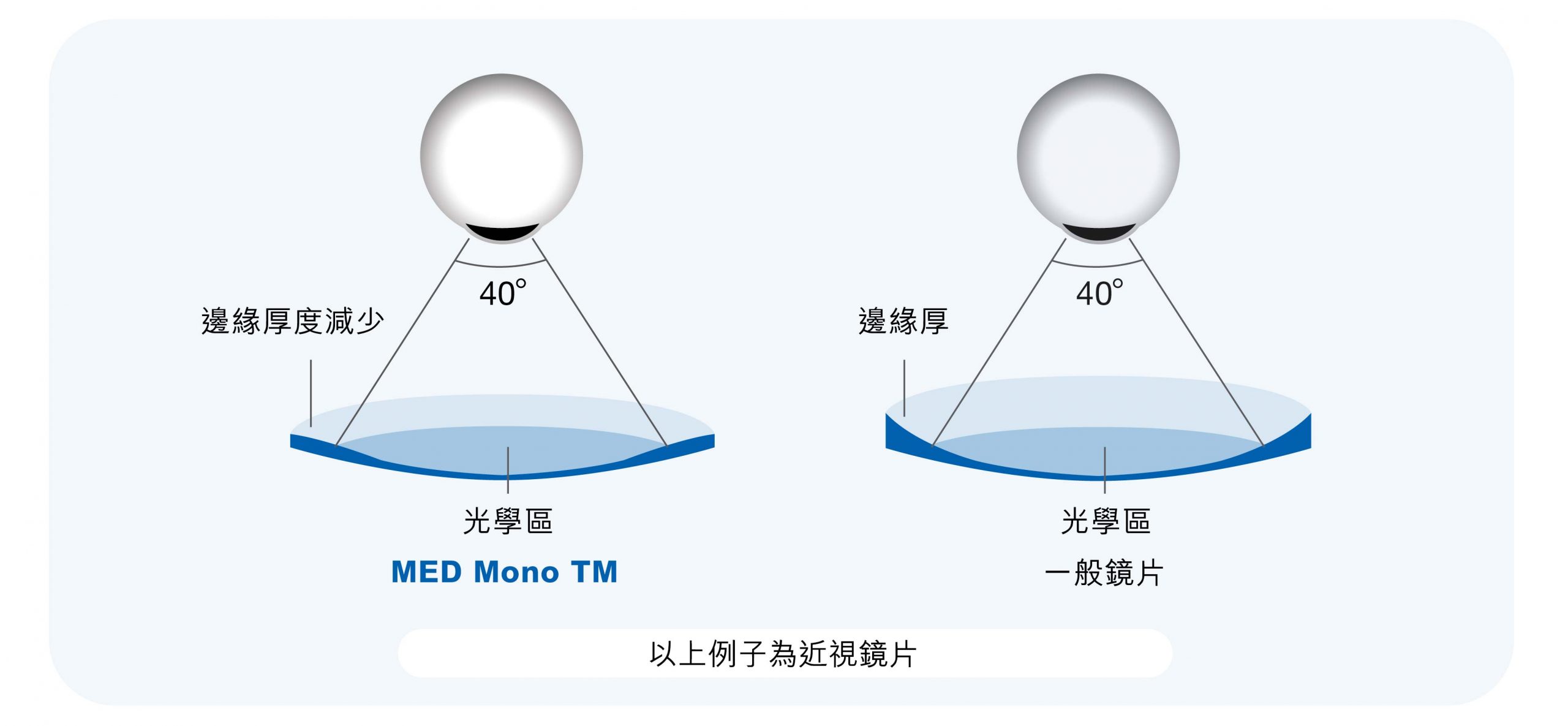 醫用屈光專用鏡- Swisscoat Offical Website | Swisscoat